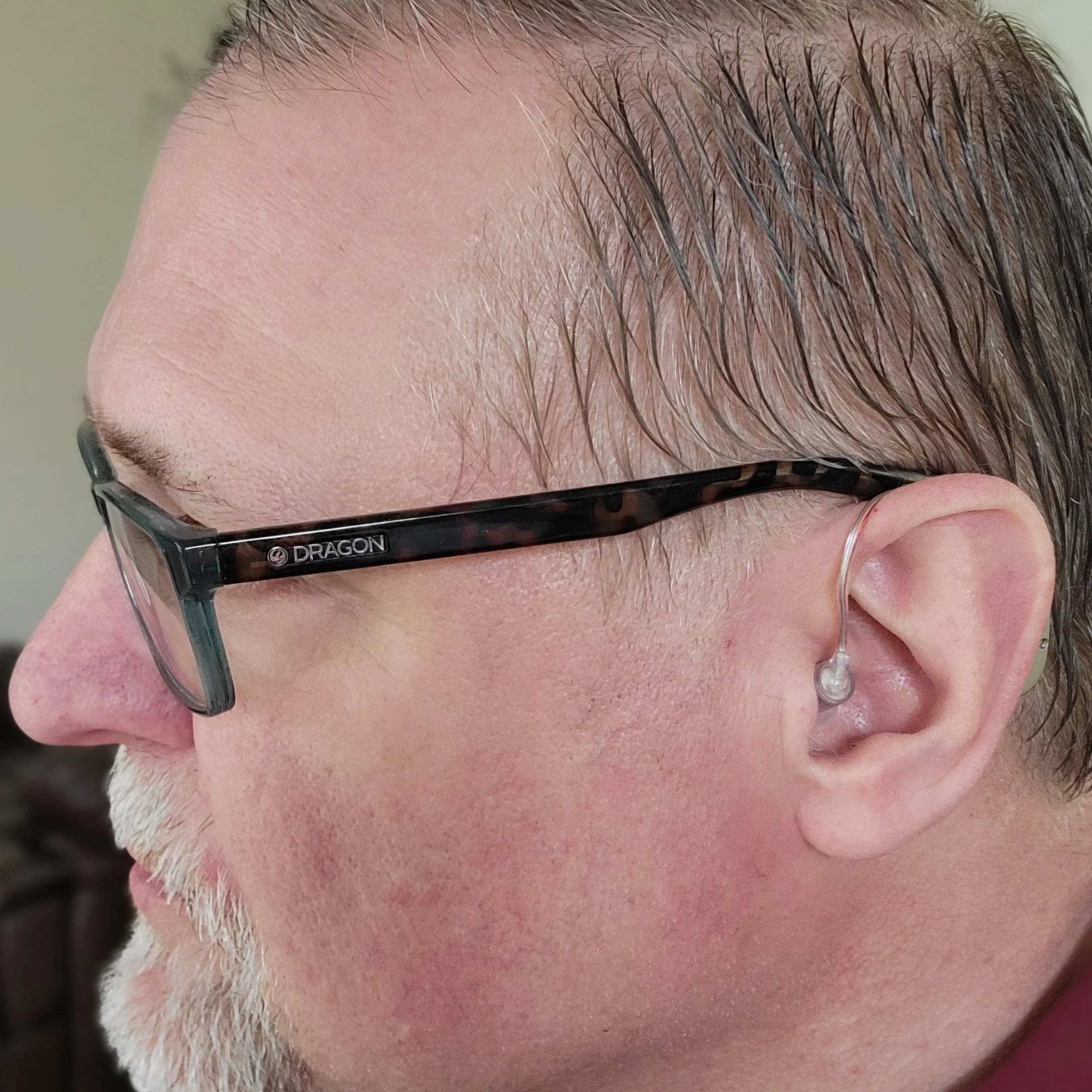 TruHear customer wearing hearing aid