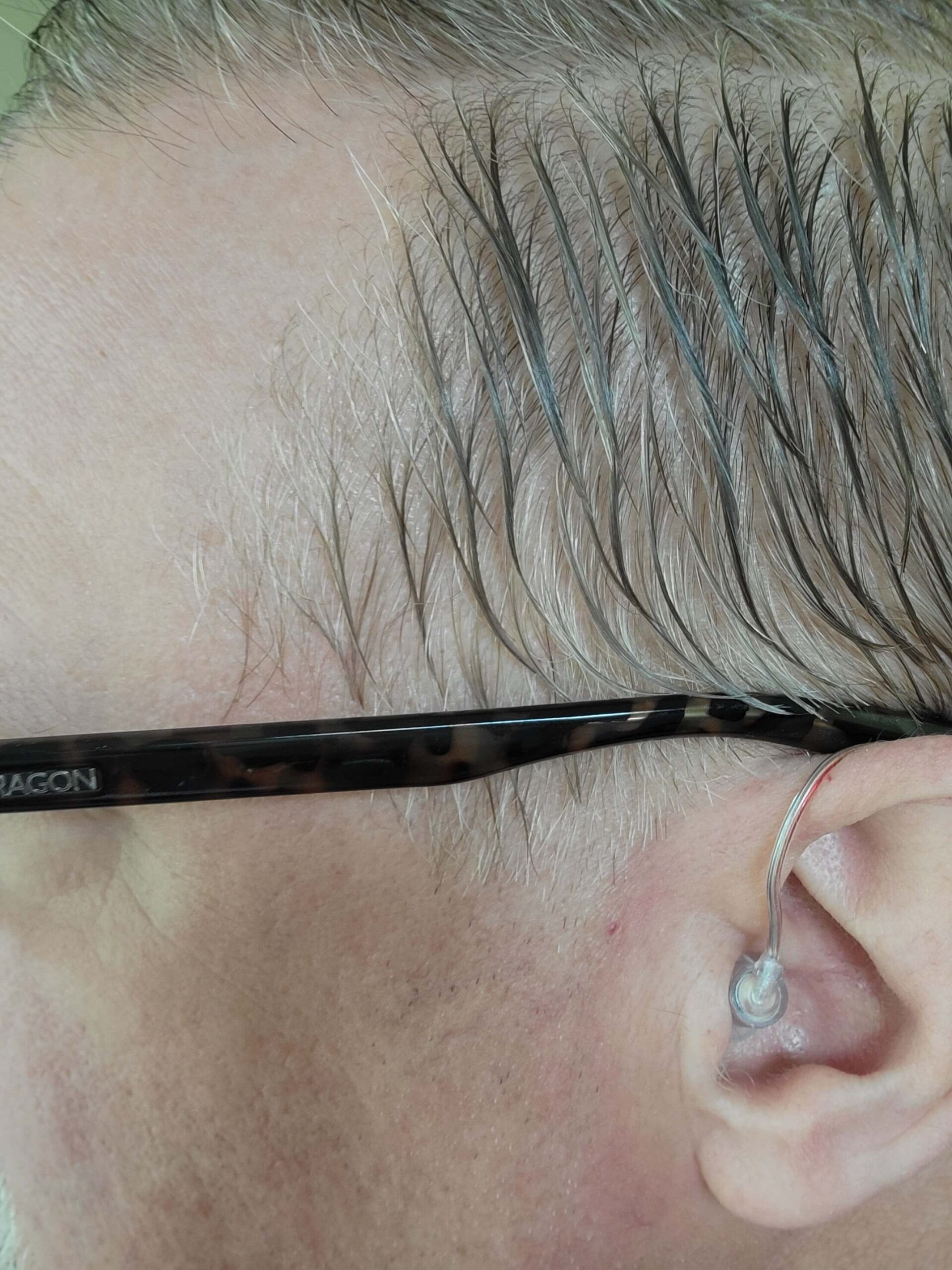 Close up of TruHear hearing aid